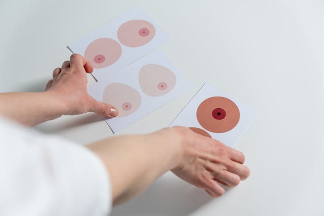 Seins Tubéreux : Comment les Reconnaître et les 3 Grades